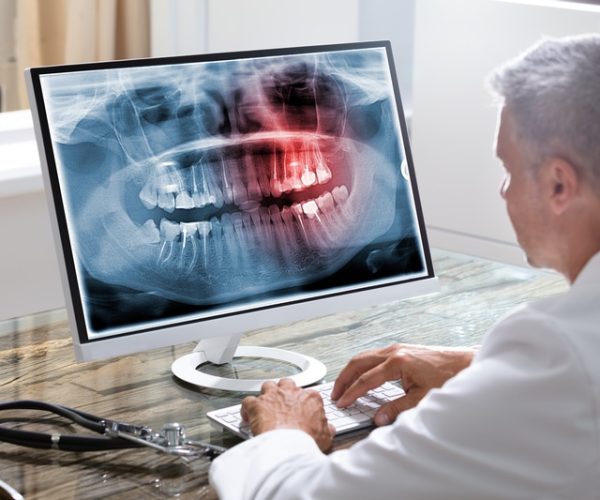 Discovering the Possibilities of Prosthodontics for Smile Renewal