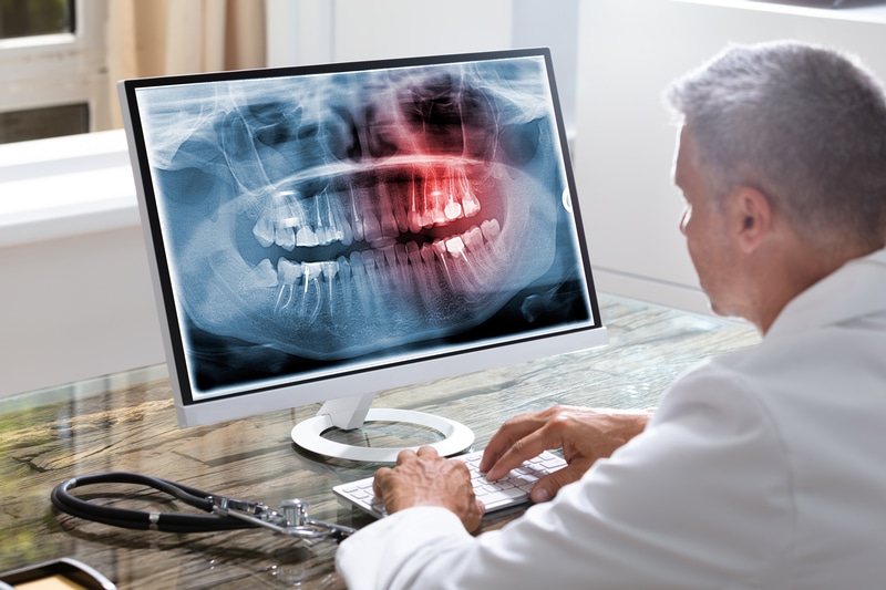 Discovering the Possibilities of Prosthodontics for Smile Renewal